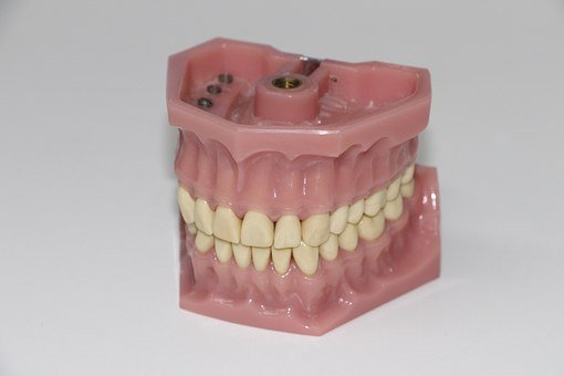 Dental Prosthesis, Artificial Teeth